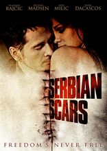 Inlay van Serbian Scars